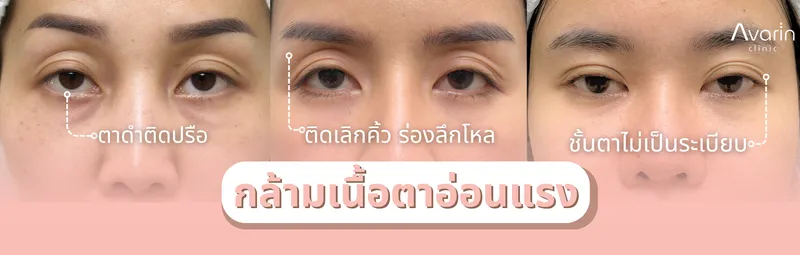 ก่อนทำ