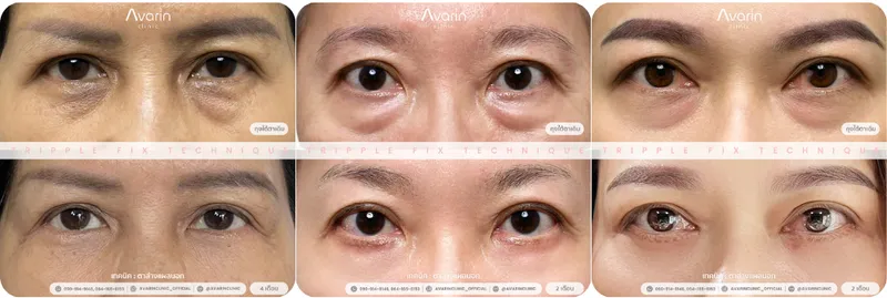 ข้อความในย่อหน้าของคุณ(1)