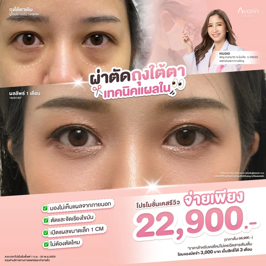 ราคาใหม่