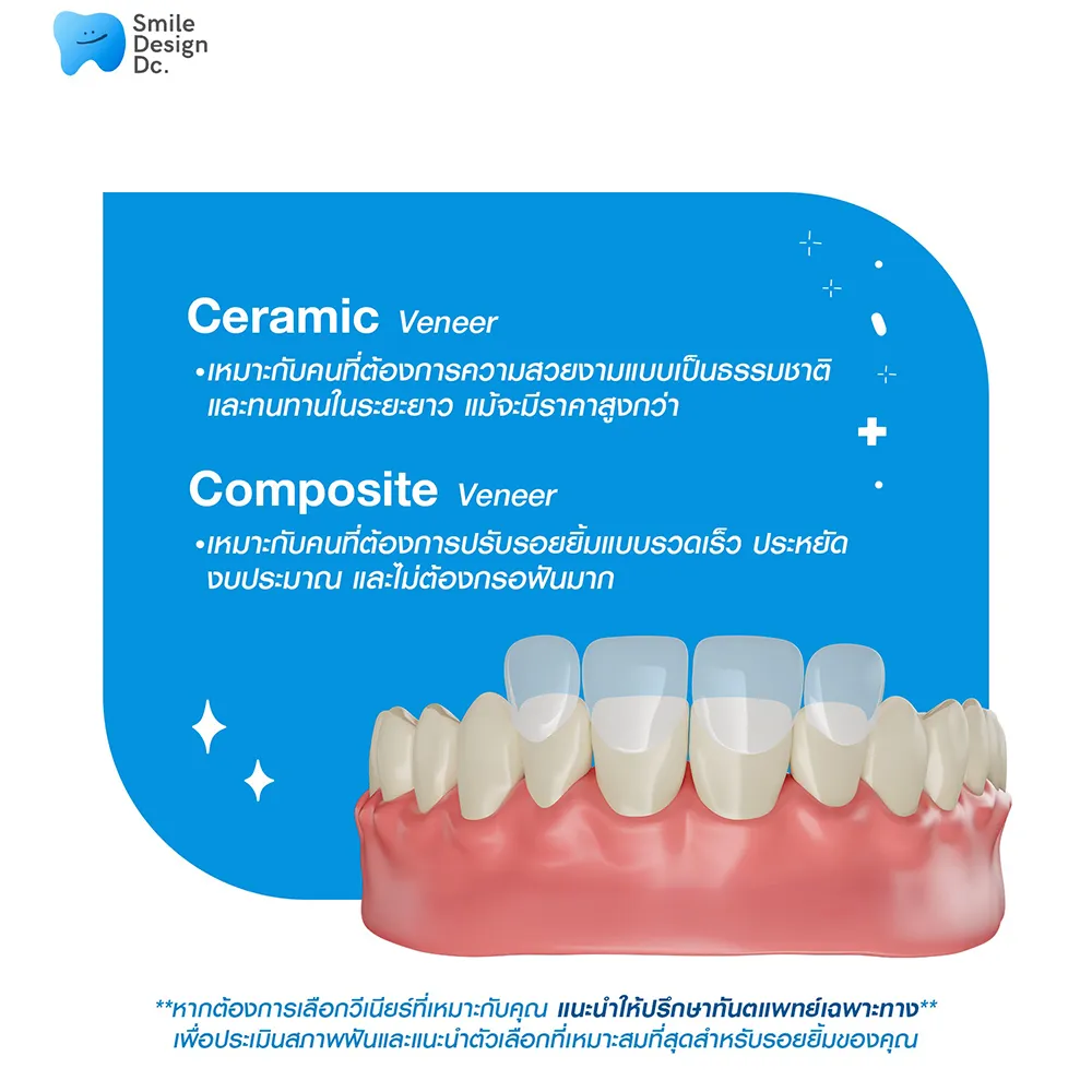 1-วีเนียร์คืออะไร