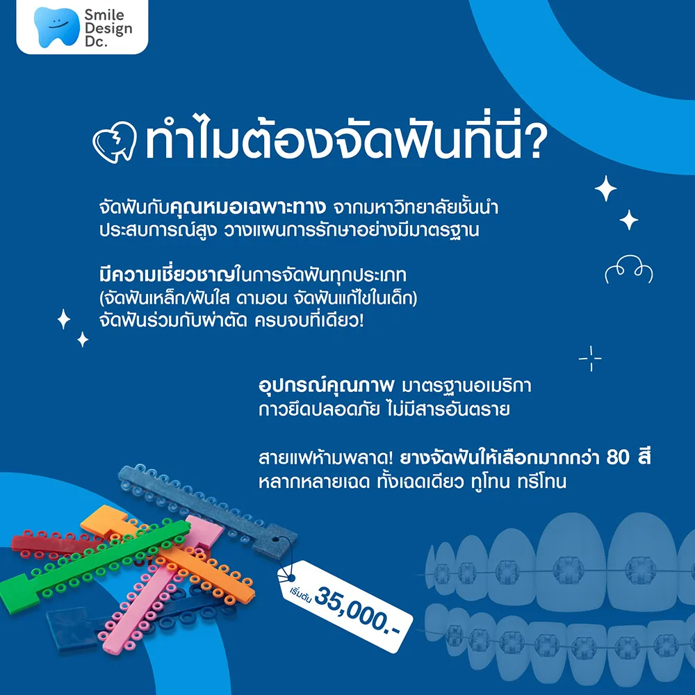 3-ทำไมต้องจัดฟันที่-คลินิกทันตกรรม-สไมล์-ดีไซน์-สีลม