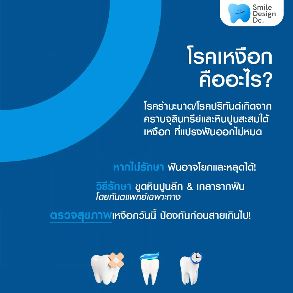 4-โรคเหงือกคืออะไร