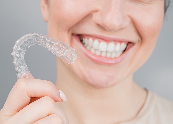 จัดฟันใส-Invisalign1