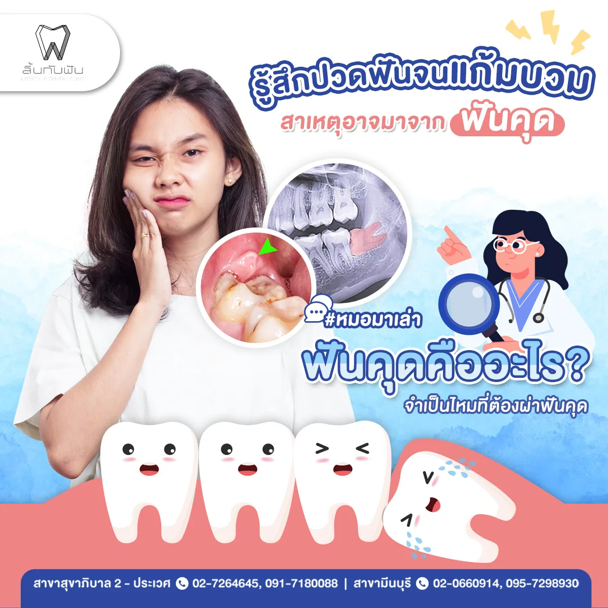 สาเหตุจากฟันคุด