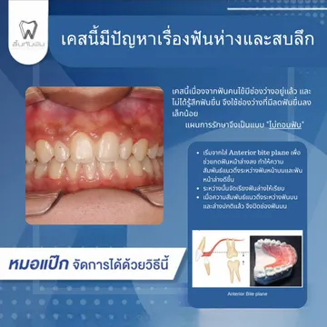 44257430