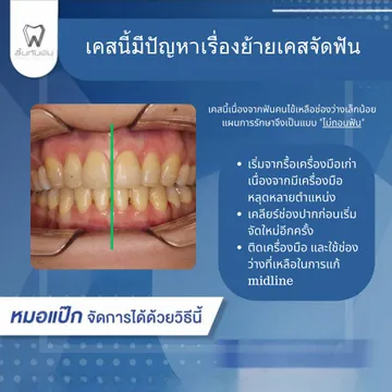 44257450