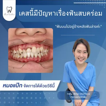 44257460