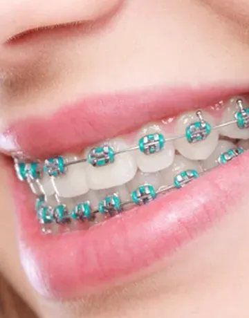 lynkubfundentalclinic-15