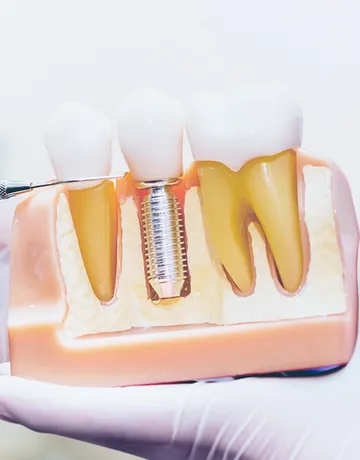 lynkubfundentalclinic-18