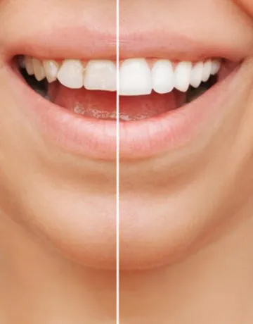 lynkubfundentalclinic-7