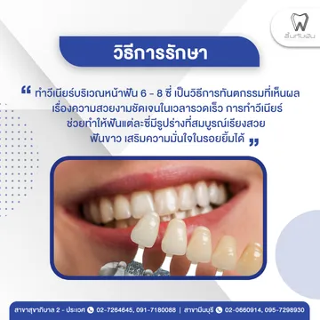 รีวิวทำวีเนียร์3