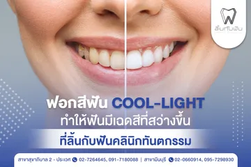 รีวิวฟอกสีฟัน1