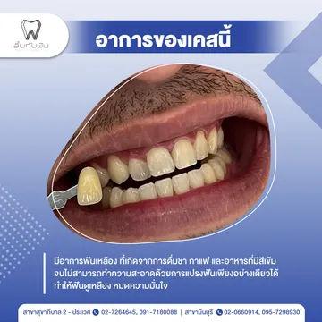 รีวิวฟอกสีฟัน2