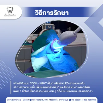รีวิวฟอกสีฟัน3