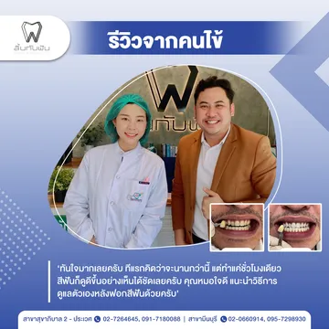 รีวิวฟอกสีฟัน