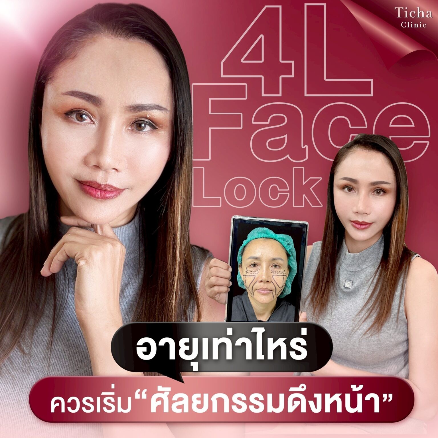 อายุเท่าไหร่ควร(