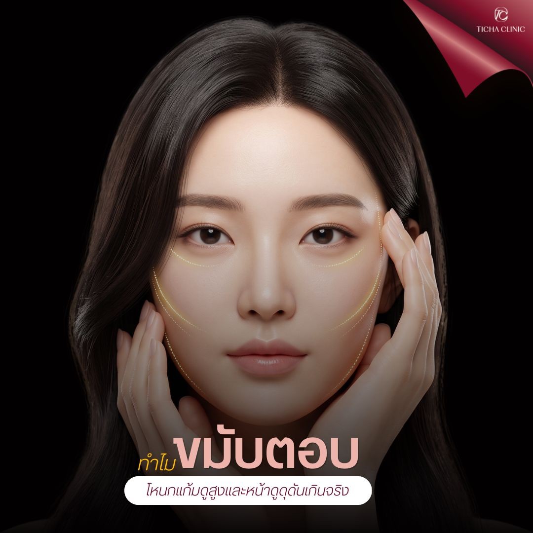 14.2 TC _ ฟิลเลอร์ขมับตอบทำให้โหนกแก้มดูสูงและหน้าดุดัน_ ปรับรูปหน้าละมุนสไตล์ลูกคุณหนูด้วยฟิลเลอร์ขมับ