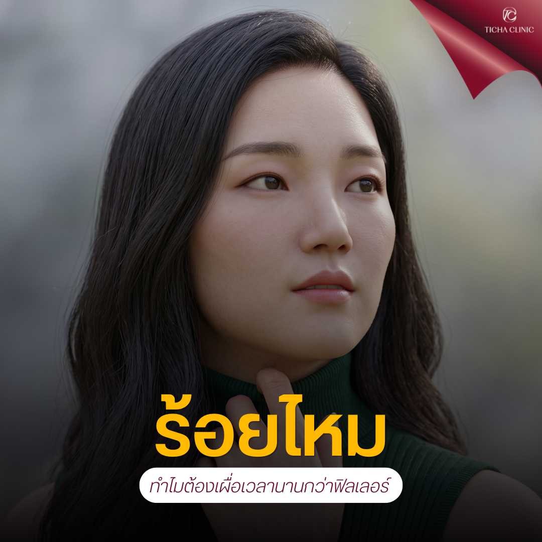 23.2 TC _ มีแพลนจะดึงหน้า ห้ามฉีดฟิลเลอร์หรือร้อยไหมล่วงหน้ากี่เดือน_ ข้อปฏิบัติสำคัญเพื่อเลี่ยงผังผืดชั้นผิว