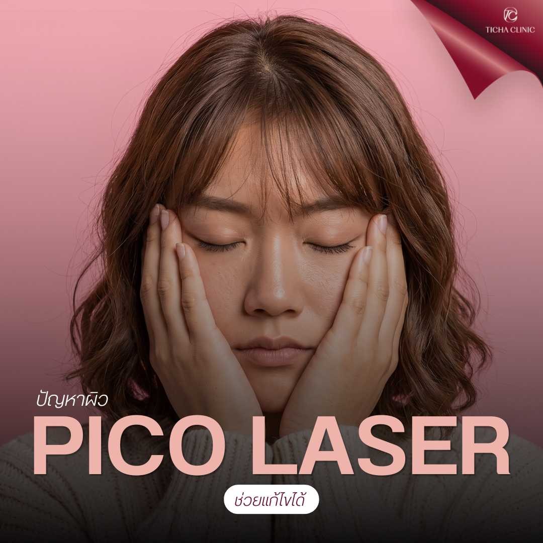 48.2 TC _ ส่องกระจกทีไรเครียดเพราะรอยดำสิวและฝ้า รีวิวเคลียร์ผิวใสด้วย Pico Laser นวัตกรรมปราบเม็ดสีที่ฮิตที่สุดในตอนนี้