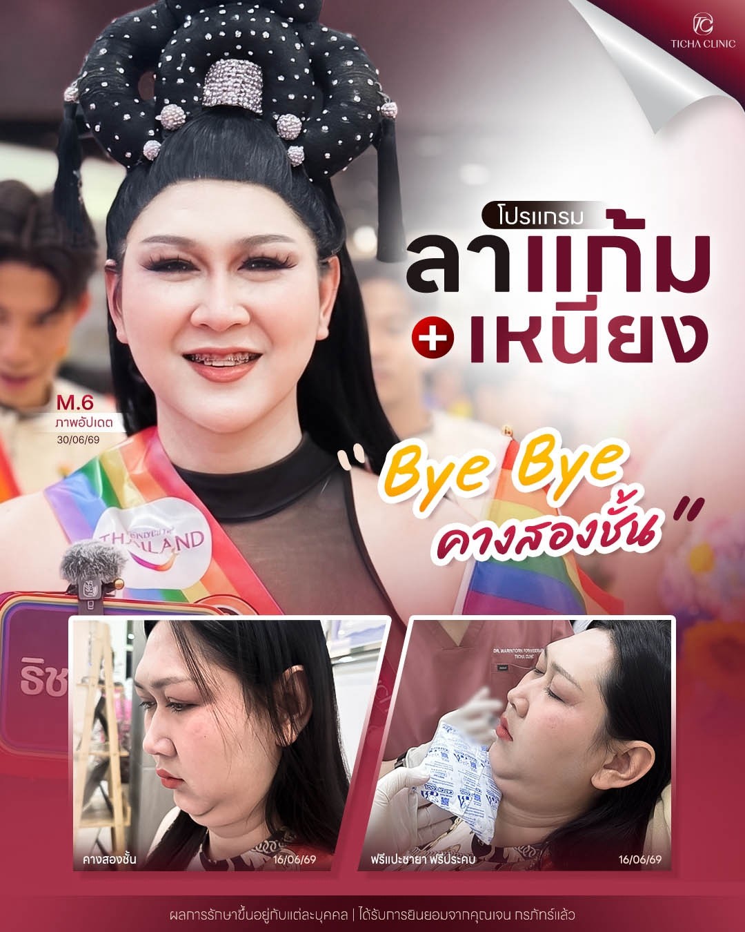 LINE_ALBUM_Skin Ticha - 3_260808_1