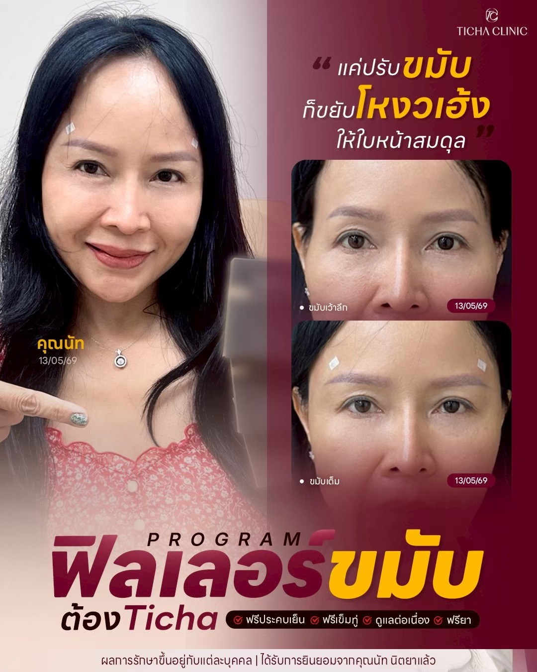 LINE_ALBUM_Skin Ticha - 3_260811_2
