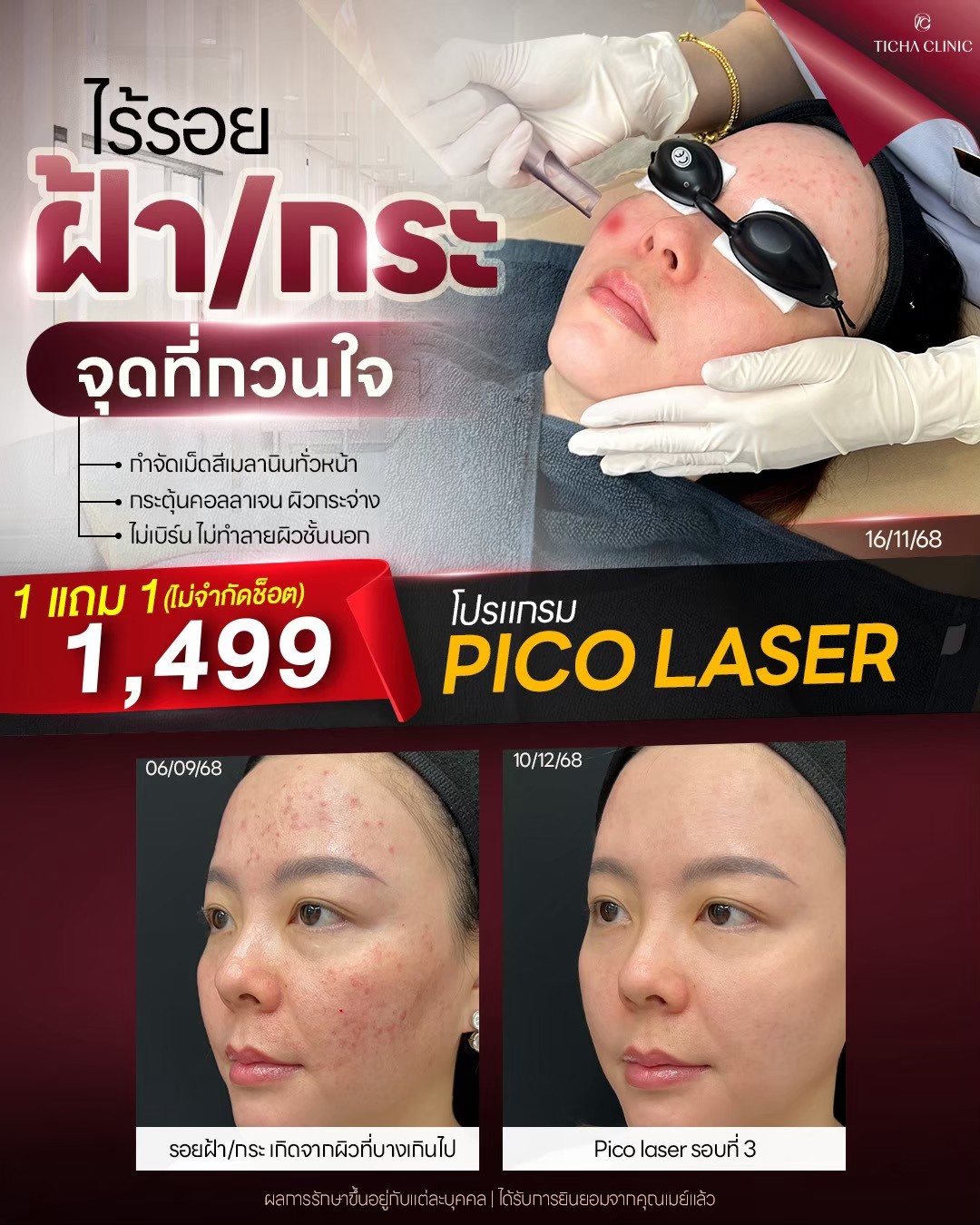 LINE_ALBUM_Skin Ticha - 3_260828_1