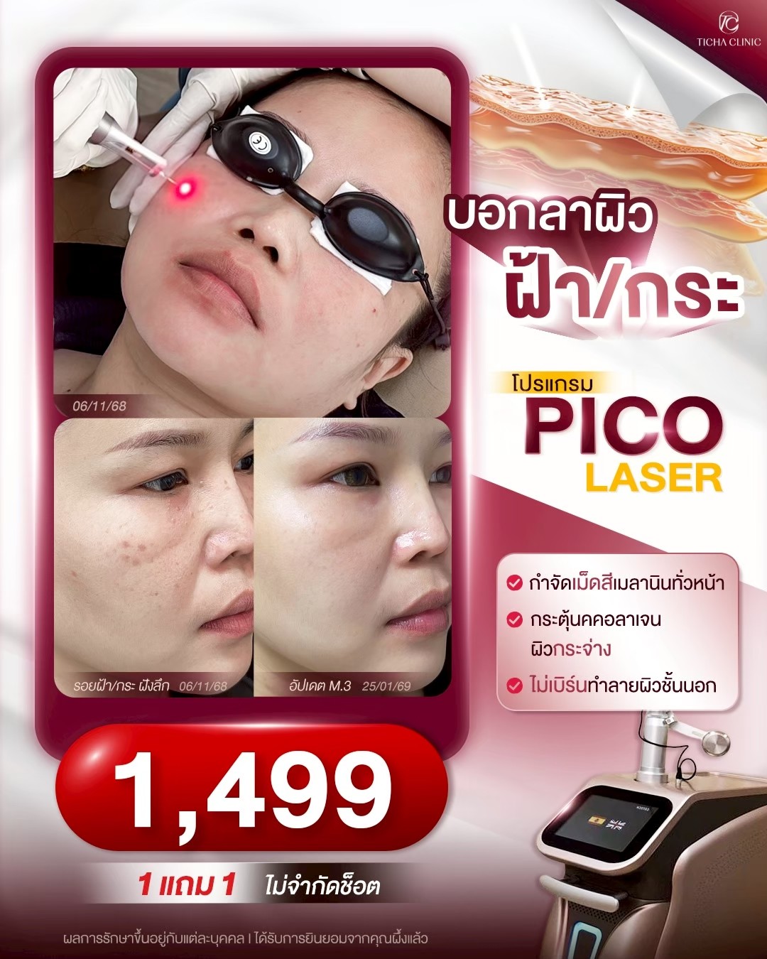 LINE_ALBUM_Skin Ticha - 3_260828_2