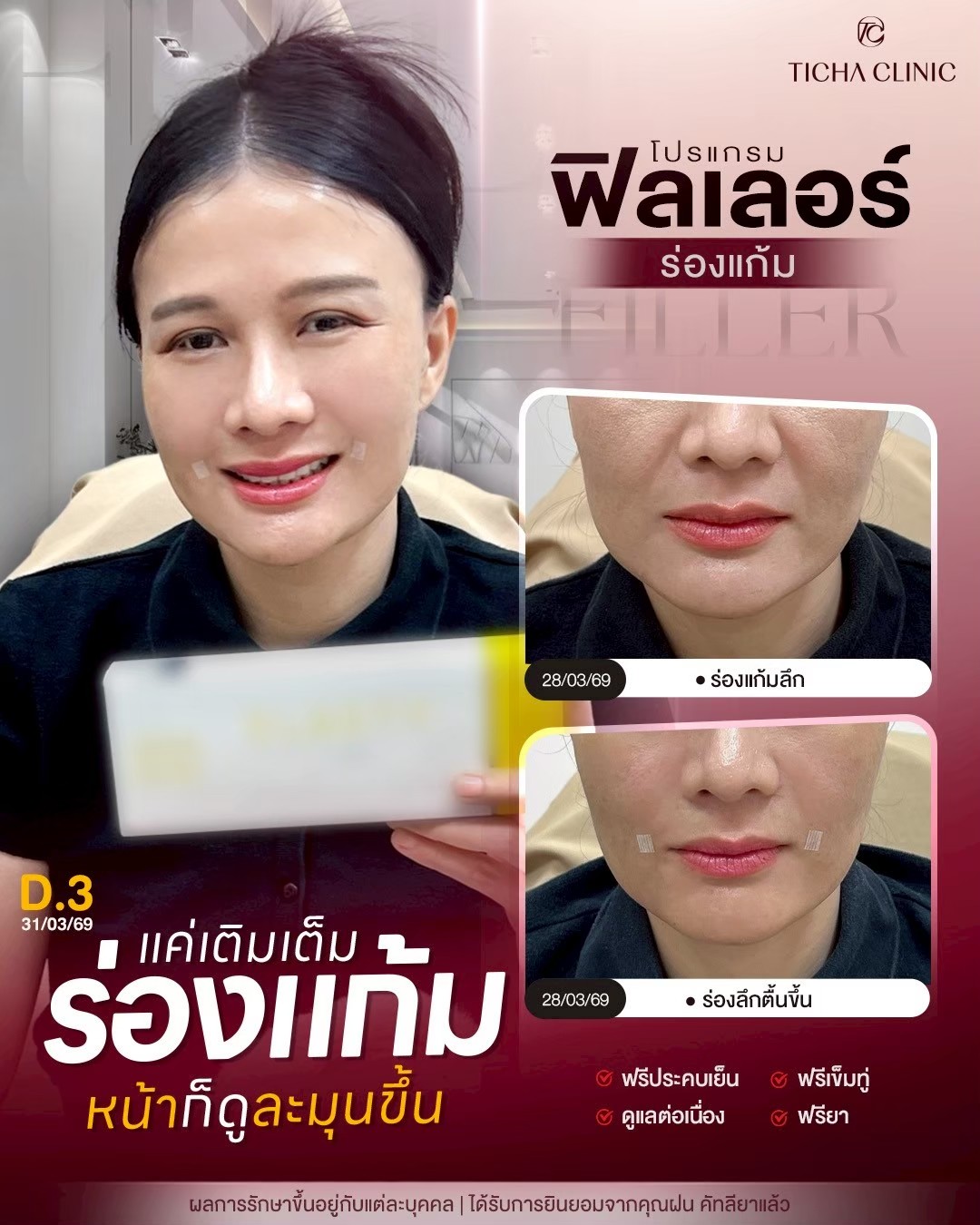 LINE_ALBUM_Skin Ticha - 3_260911_2