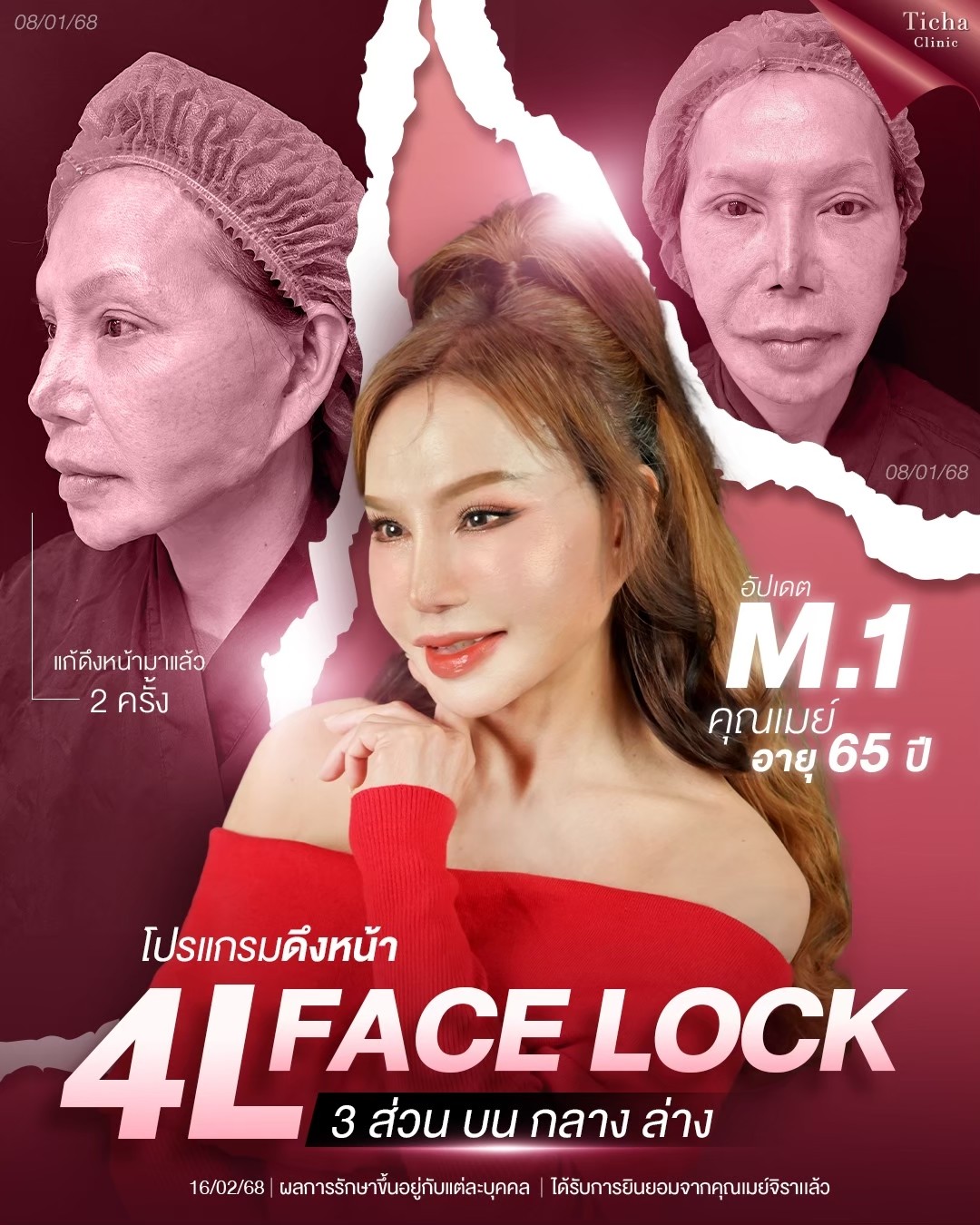 LINE_ALBUM_ดึงหน้า Face Lock TC_260826_2