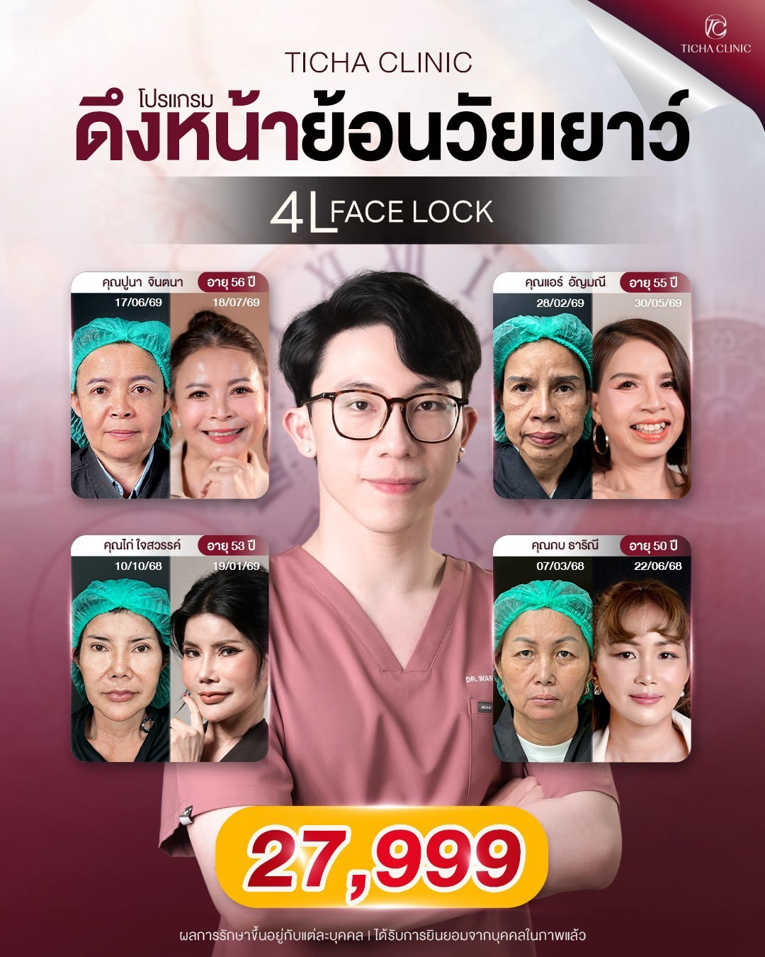 LINE_ALBUM_ดึงหน้า Face Lock TC_260902_1
