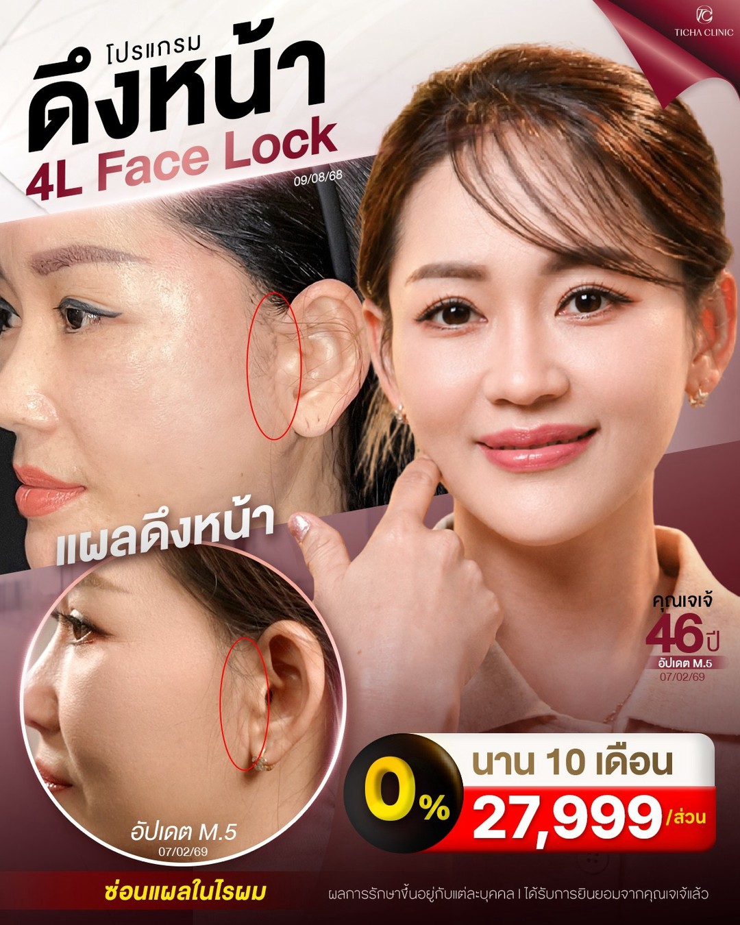 LINE_ALBUM_ดึงหน้า Face Lock TC_260902_2
