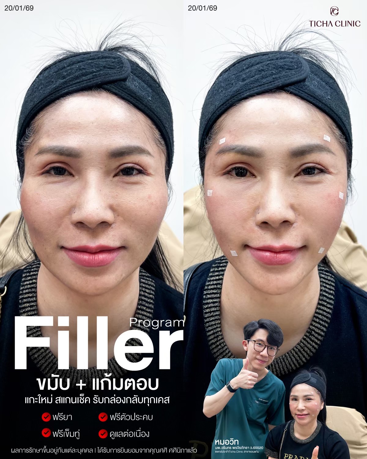 LINE_ALBUM_Skin Ticha - 3_260811_1