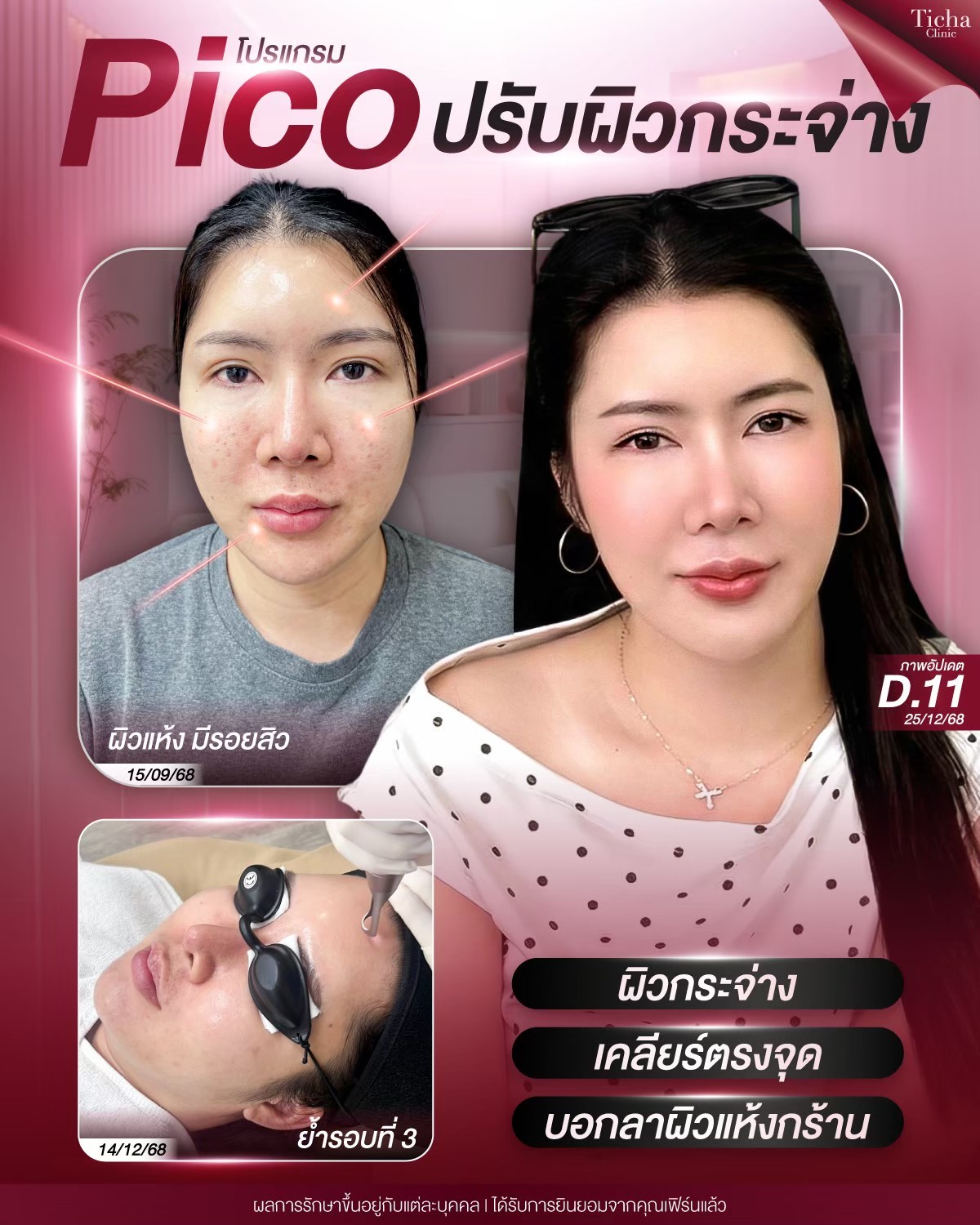 LINE_ALBUM_Skin Ticha - 3_260811_1