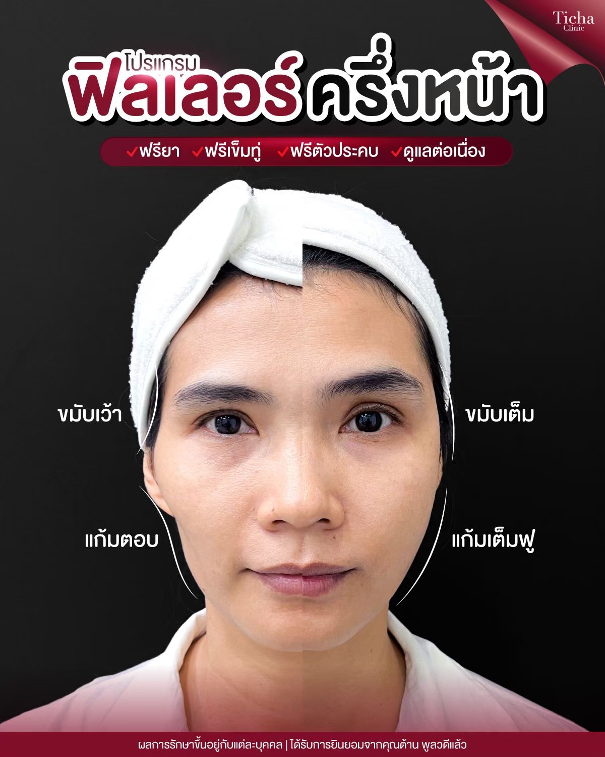LINE_ALBUM_Skin Ticha - 3_260910_1