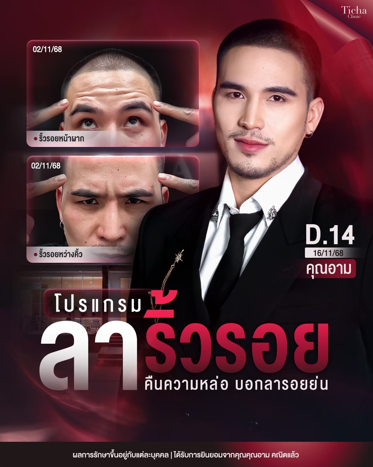 LINE_ALBUM_Skin Ticha - 3_260910_2