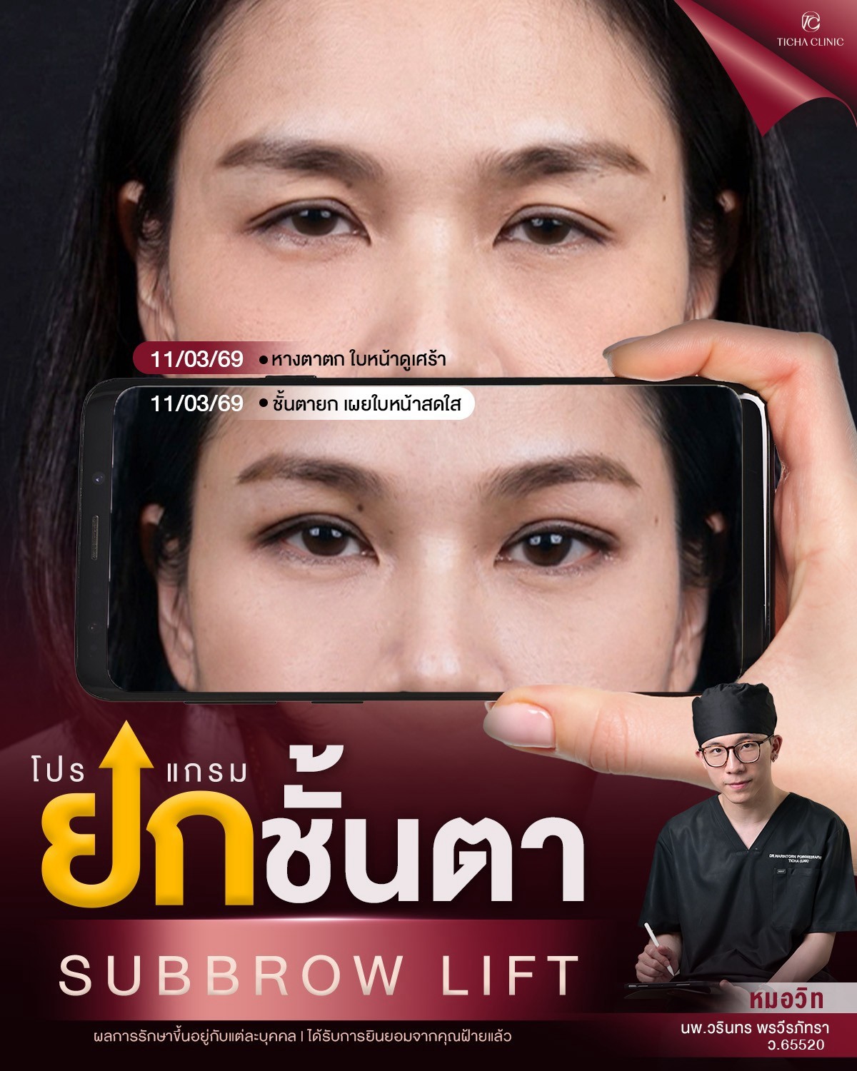 LINE_ALBUM_ซับบราว-Subbrow TC_260808_2