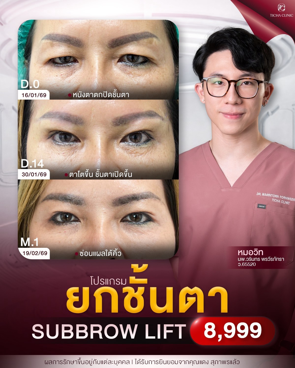 LINE_ALBUM_ซับบราว-Subbrow TC_260825_1