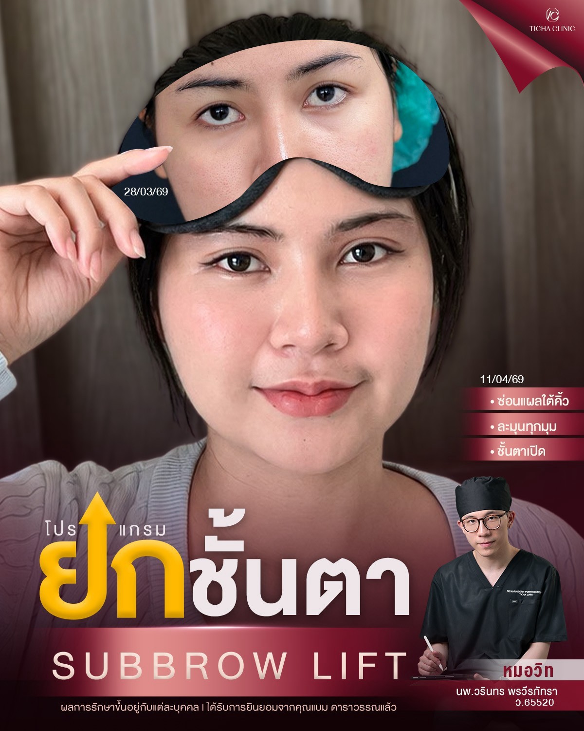 LINE_ALBUM_ซับบราว-Subbrow TC_260825_2