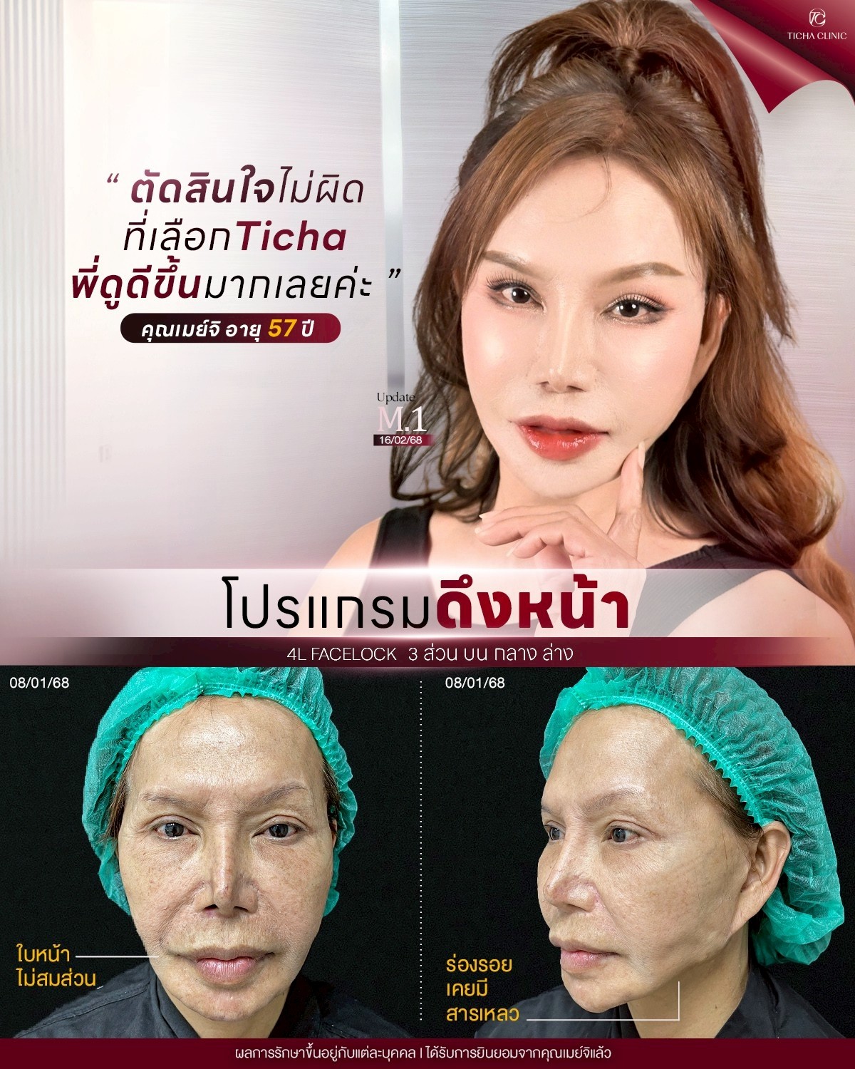 LINE_ALBUM_ดึงหน้า Face Lock TC_260812_2