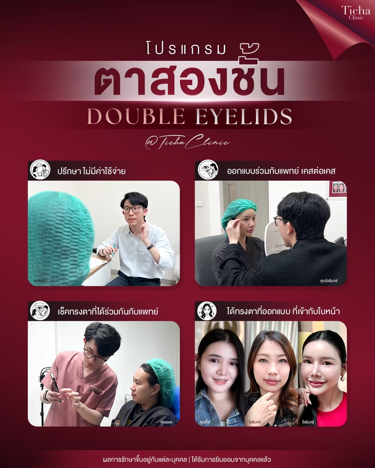 LINE_ALBUM_ศัล ตา2ชั้น - TICHA CLINIC_260818_2