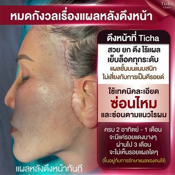 img-article03