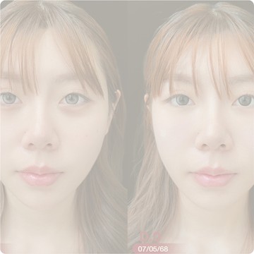 img-review02