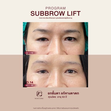 คุณฉัตร