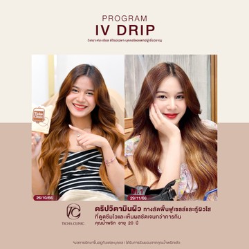 คุณน้ำพริกดริปผิว
