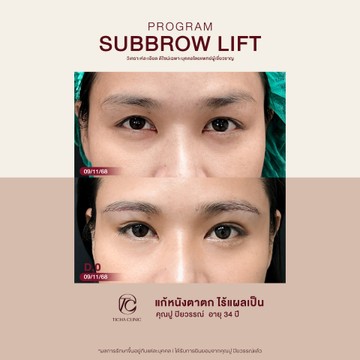 คุณปูปิยวรรณ์