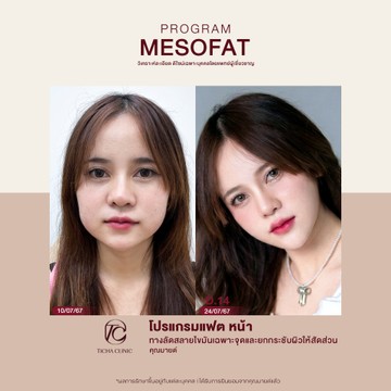 คุณมายด์-แฟตหน้า