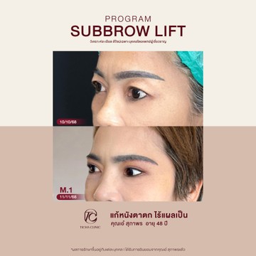 คุณเอ๋สุภาพร