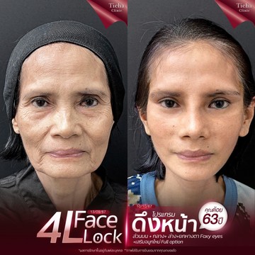 ภาพประกอบบทความ