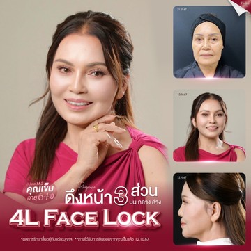 ภาพประกอบบทความ