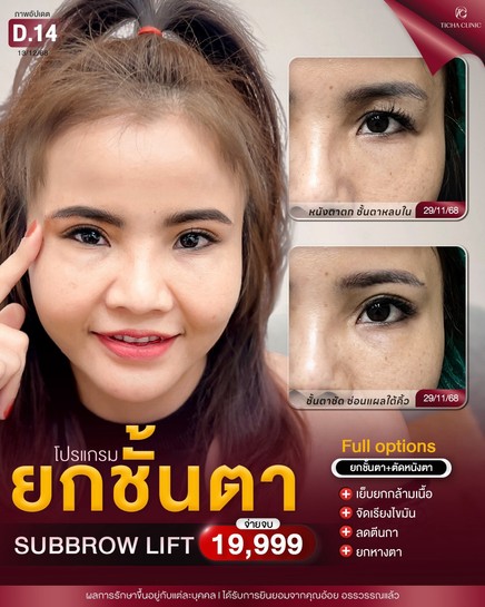 LINE_ALBUM_ซับบราว-Subbrow TC_261021_2